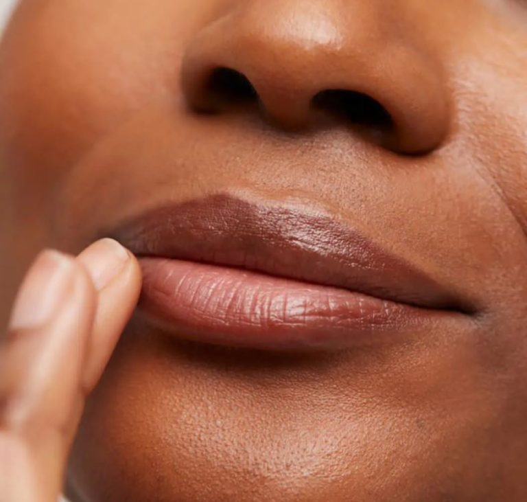 5 Motive pentru Filler in Buze