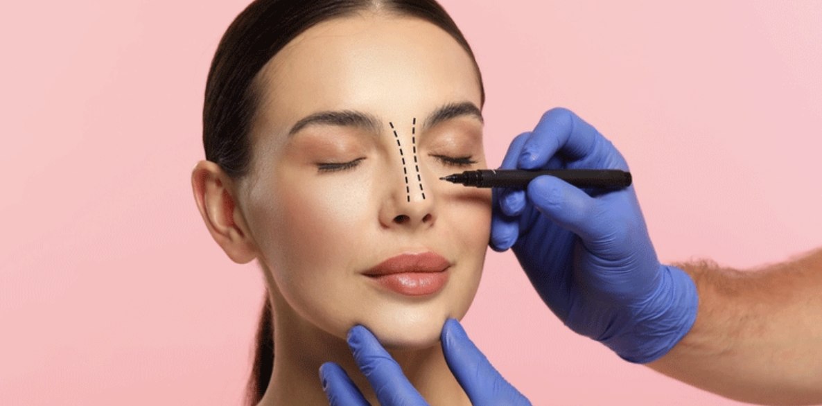 Rinoplastia în 2026 | aesense.ro