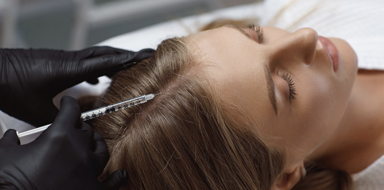 Mezoterapia pentru păr: Cum funcționează și când vezi rezultate
